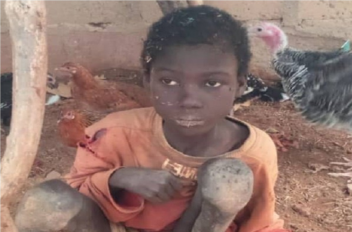 Boy chained for two years by his father