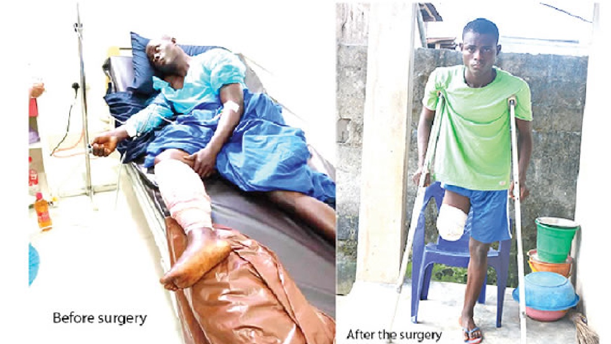 My leg was amputated after I was shot at Lekki Toll Gate — 23-year-old cobbler