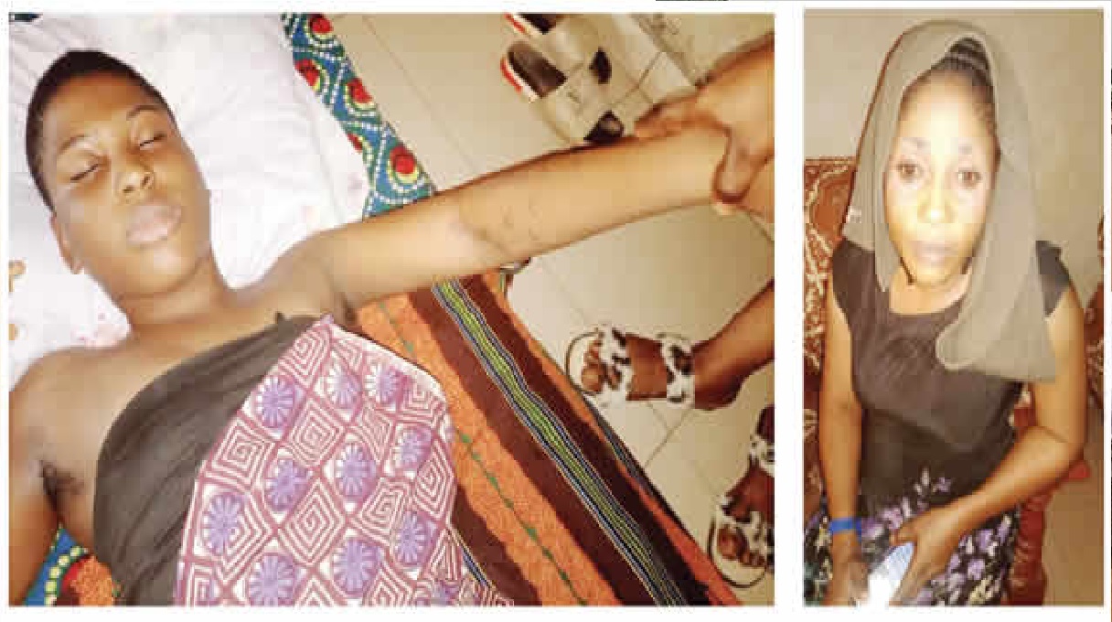 Lack of funds delaying surgery to remove bullets from my daughter’s arm –Ekiti woman