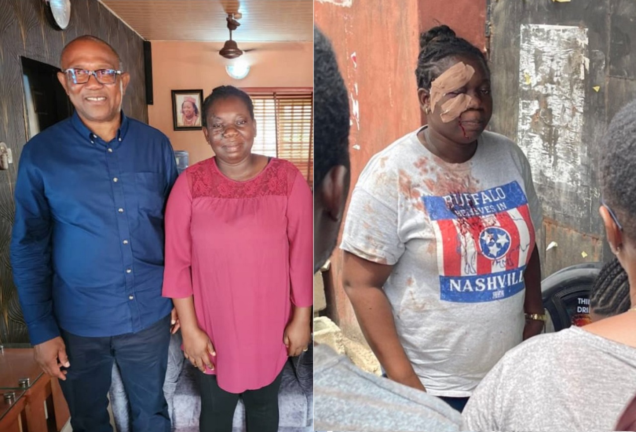 Peter Obi visited woman who attacked in Lagos during the Presidential election